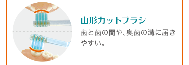 山形カット:ブラシ歯と歯の間や、奥歯の溝に届きやすい。