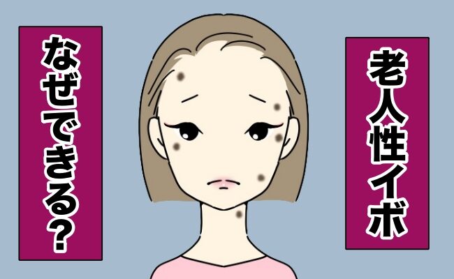 老人性イボイメージ