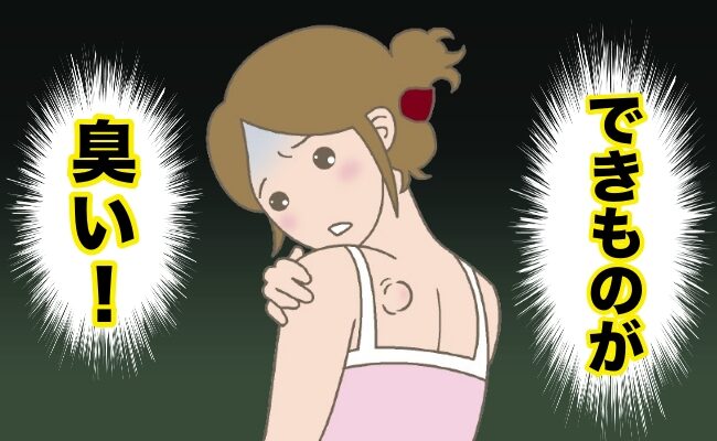 できものが臭いイメージ