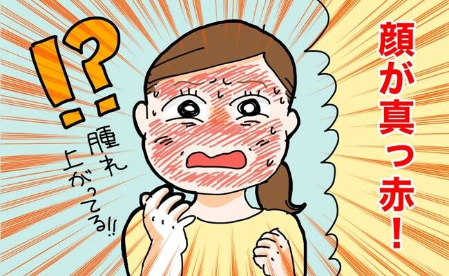 突然、顔が真っ赤に腫れ上がり…40代で起こった頑固な肌荒れで生活習慣を見直し【体験談】