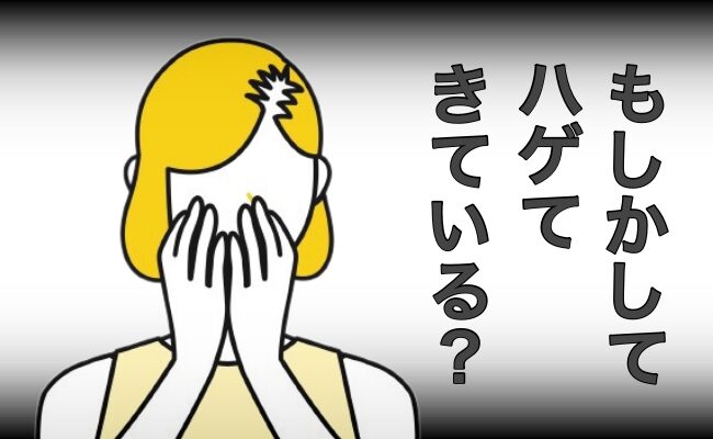 ハゲが気になるイメージ