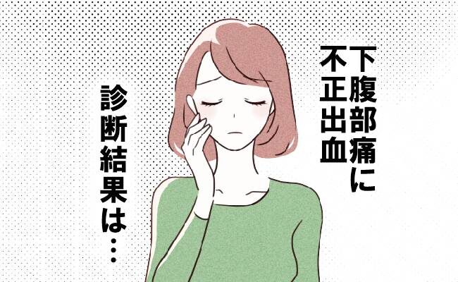 婦人科を受診した女性
