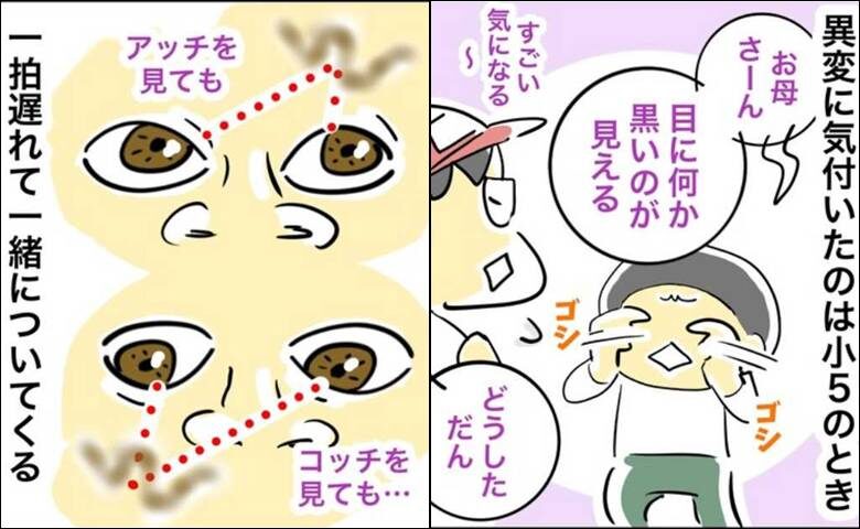 緑内障ダイアリー／へそ