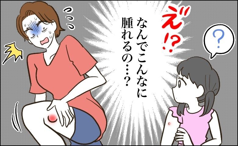 「ただの虫刺されが、まさかの悪化…」40代の肌に起きた肌トラブルとは【体験談】