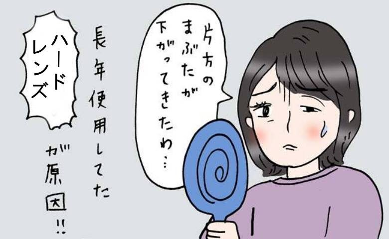 目の左右差が気になる女性