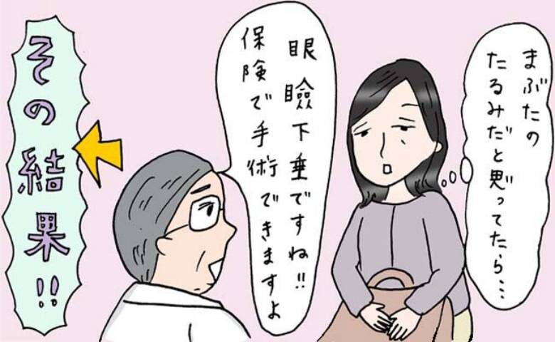 眼瞼下垂の女性