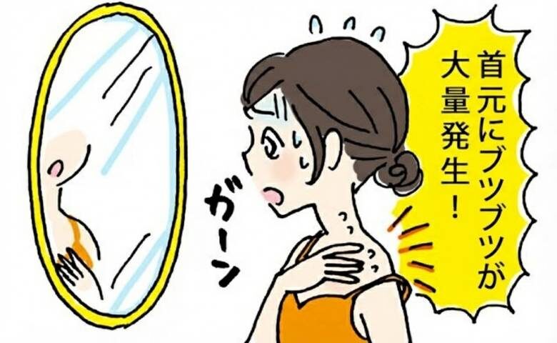 イボができた女性