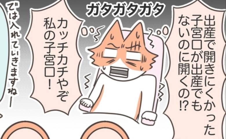 貧血から見つかった子宮筋腫／宮島もっちー