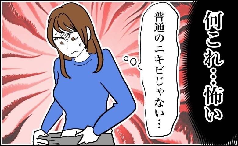 粉瘤ができた女性