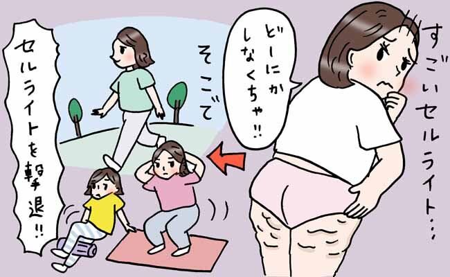 セルライトが気になる女性